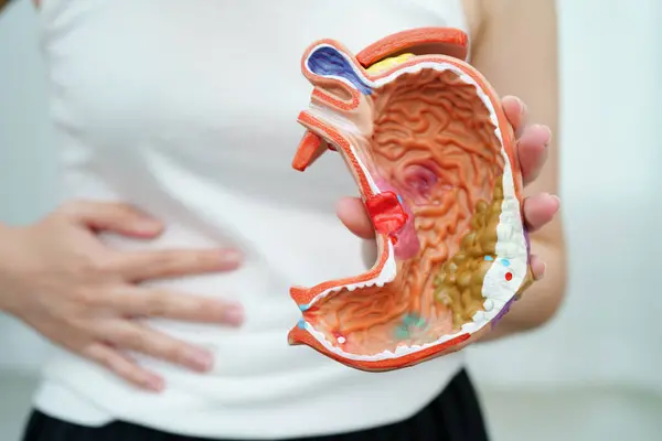 Mide hastalığı, Asyalı bir kadın hastanede teşhis ve tedavi için anatomi modeli tutuyor..