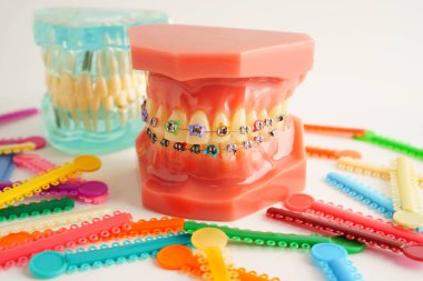 Ortodontik bağlar halkalar ve kravatlar, diş hekimliği üzerine çalışan dişçi için model..