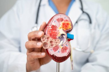 Kronik böbrek hastalığı, idrar sistemi, üroloji, tahmini küresel filtreleme oranı eGFR.