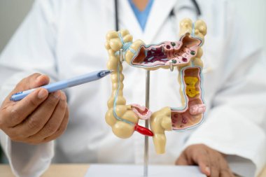 Bağırsak, hastanede teşhis ve tedavi için insan anatomisi modeli tutan doktor..