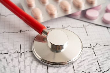 Elektrokardiyogram, EKG, kalp dalgası, kalp krizi, kardiyogram raporu.