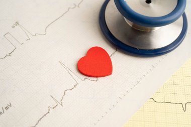 Elektrokardiyogram, EKG, kalp dalgası, kalp krizi, kardiyogram raporu.