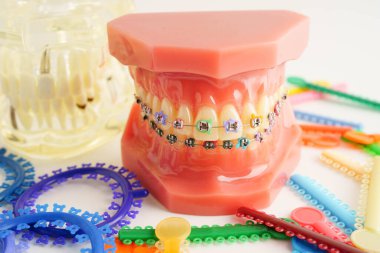 Ortodontik bağlar halkalar ve kravatlar, diş hekimliği üzerine çalışan dişçi için model..