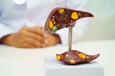 Pankreas iltihabı, pankreas hastası Asyalı doktor, safra kesesi ve safra kesesi insan anatomisi modeli..