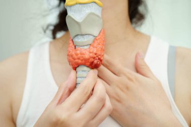Hipertiroidizm, aşırı aktif tiroid, tiroid lenfoma, tiroid bezi insan anatomisi olan Asyalı kadın..
