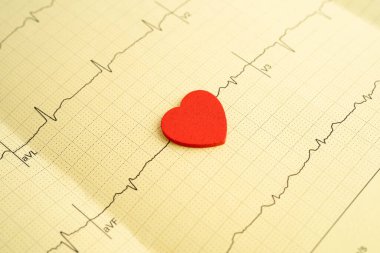 Elektrokardiyogram EKG, kalp dalgası, kalp krizi, kardiyogram raporu.
