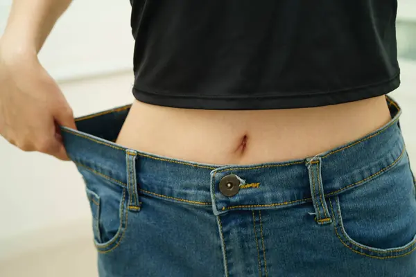 Bacağında selülit olan Asyalı bir kadın. Cildinde yağ, aşırı kilolu..