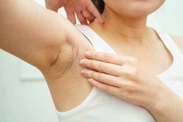 Азиатка имеет проблемы черный подмышки красоты ухода за кожей.