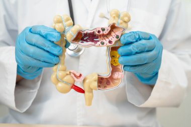 Bağırsak, hastanede teşhis ve tedavi için insan anatomisi modeli tutan doktor..