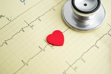 Elektrokardiyogram, EKG, kalp dalgası, kalp krizi, kardiyogram raporu.