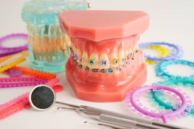 Ortodontik bağlar halkalar ve kravatlar, diş hekimliği üzerine çalışan dişçi için model..