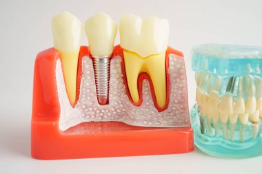 Diş hekimliği hakkında bilgi almak için beyaz arkaplanda diş modeli.