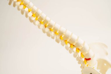 Omurga ve kemik, bel kemiği yerinden oynamış disk parçası, ortopedi bölümünde tedavi için model..