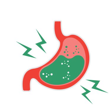 Gastroözofageal reflü hastalığı kavramı. İnsan mide mide asit, kesme görünümü dolu. Düz stil vektör çizim.