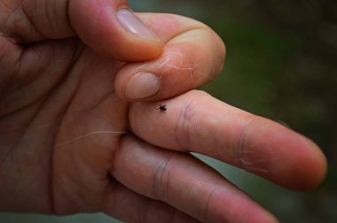 Enfekte olmuş bir böcek kenesi insan elinin derisinde sürünür. Karanlık bir arka planda izole edilmiş. Kene arka bahçedeki kedinin üzerindeydi. Bir parazit kenesi..