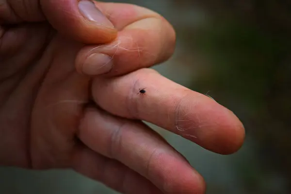 stock image Tick walking on human arm taken off pet cat, veterinarian