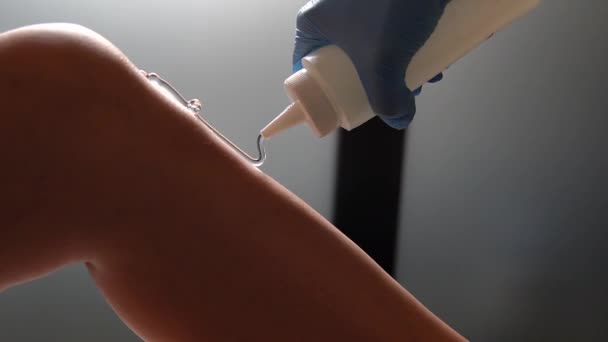 激光脱毛治疗 熟练的激光技师在使用手持激光装置去除不想要的头发之前 在病人的腿上涂上保护胶 — 图库视频影像