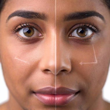 A high-resolution ultrarealistic image capturing a close-up of a person's face divided into two halves, demonstrating a 'before and after' effect. On the left side, visible wrinkles and signs of aging are present below the eye, highlighted by dotted clipart