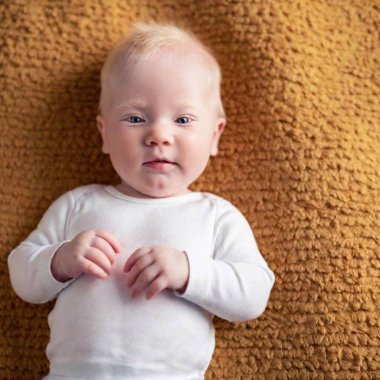 A full shot of an infant baby with Albinism, lying on a soft surface in a studio. Flat lay perspective, rack focus moving from the baby's delicate facial features to the textured blanket beneath them. clipart