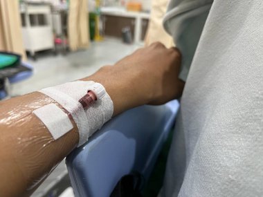 Hastanın koluna serumdan kateter takılmış bir şekilde tıbbi tedavi ve sağlık prosedürünü gösteren yakın çekim..