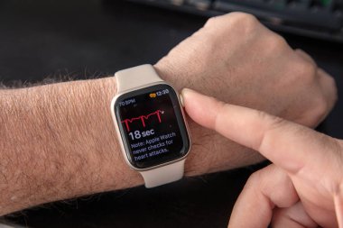 28 Ocak 2025. Atina Yunanistan. Erkek bileğinde Apple akıllı saati, yakın plan. Elektrokardiyogramlı EKG ekran, sağlık uygulaması