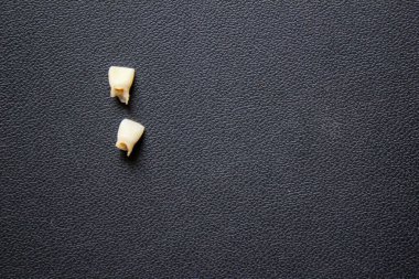 Siyah arka planda yeni kaybolmuş bir bebek dişi.