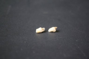 Siyah arka planda yeni kaybolmuş bir bebek dişi.