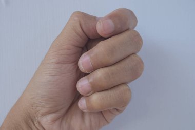 Çivinin şekli ağızdan kesildiği için hasar görmüş. Tırnaklar soyulur ve manikür yapılmadan kırılgan hale gelir. Tırnak derisi tekrar uzar ve tırnak tabakları jöle ojesinden sonra zarar görür..