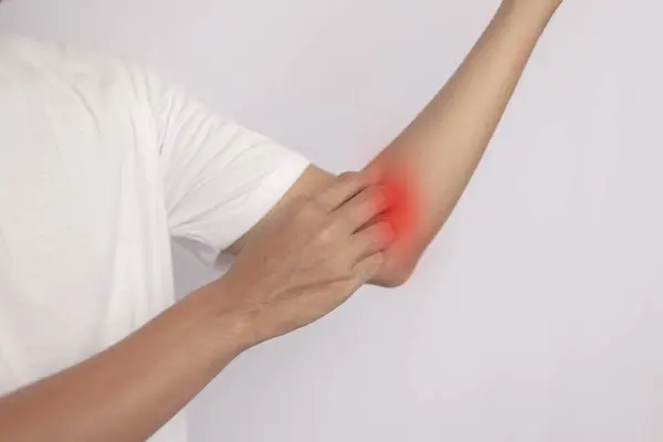 Genç Asyalı erkek dermatolojisi, erkek alerjisi atopikten kaynaklanan alerjik reaksiyon, kolunda böcek ısırığı, kaşınan eller ya da deri döküntüsü. Sağlık hizmetleri, erkeklik ve kadınlık hizmetleri.