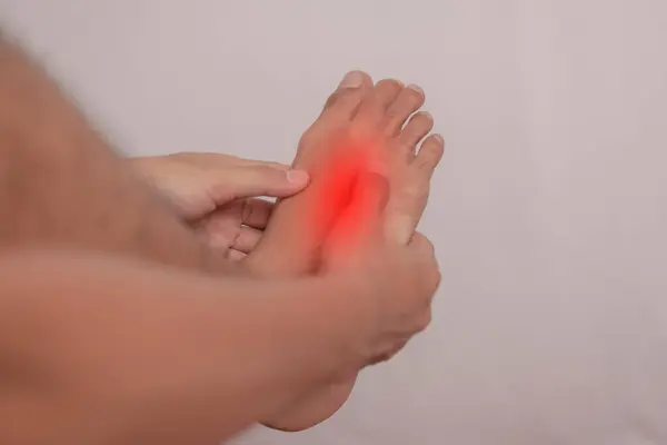 Bir adamın bacağı gut hastalığına yakalanır. Ayaklar, ellerle tutulan ayaklarda iltihaplanma yaşar. Yaya iltihabı üzerine sağlık kavramı.