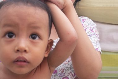 Çocuk atopik dermatitten etkilenen deriyi tırmalıyor. Çocuk, atopik dermatitten, diyatezden, çocuğun vücudundaki alerjilerden etkilenen cilde özel krem sürer..