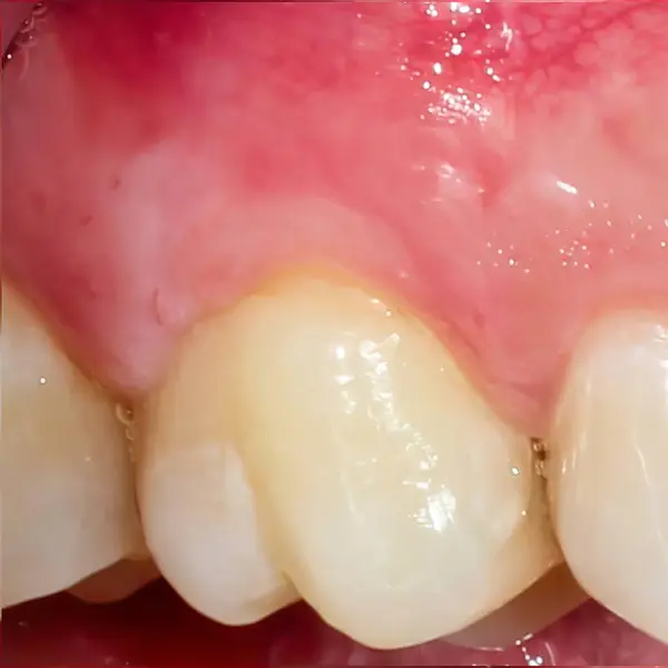 Parlak, beyaz bir tebessüm sergileyen bir insan ağzı. Görüntü sağlıklı ve güzel dişleri ön plana çıkarıyor..