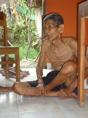 2010 'da Merapi Dağı' nın patlamasının ardından 80 yaşından büyük bir adam evini kaybetti, Yogyakarta.