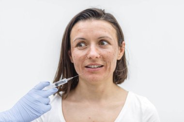 Kadının kameraya sakin ve üzgün bir bakışla, kuru bir ciltle ve cildine enjekte edilmiş tıbbi eldivenle bakışını yakından çek. Dermatoloji kavramı.