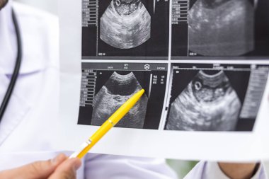 Doktorun laboratuvar önlüğü giyerken çekilmiş fotoğrafı hastasına ultrason sonuçlarını gösteriyor. Sağlık hizmetleri kavramı.