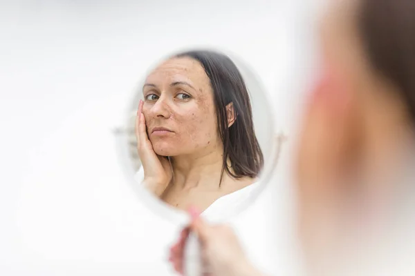 鏡を見ると肌の不具合のある女性の写真 スキンケアの概念 ストックフォト