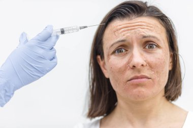 Kadının kameraya sakin ve üzgün bir bakışla, kuru bir ciltle ve cildine enjekte edilmiş tıbbi eldivenle bakışını yakından çek. Dermatoloji kavramı.