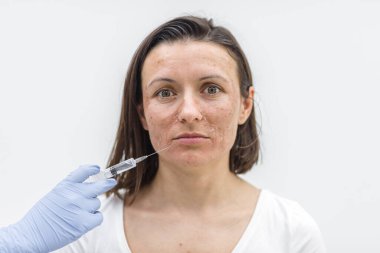 Kadının kameraya sakin ve üzgün bir bakışla, kuru bir ciltle ve cildine enjekte edilmiş tıbbi eldivenle bakışını yakından çek. Dermatoloji kavramı.