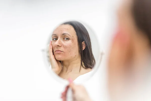 鏡を見ると肌の不具合のある女性の写真 スキンケアの概念 ストック写真