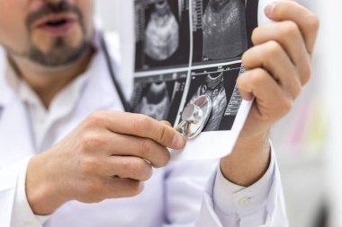 Doktorun laboratuvar önlüğü giyerken çekilmiş fotoğrafı hastasına ultrason sonuçlarını gösteriyor. Sağlık hizmetleri kavramı.