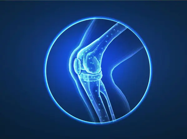 Diz eklemi mavi üzerine izole edilmiş. Kemik sağlığı, fizyoterapi, eklem bozukluğu, glukozamin onarımı, ortopedik ameliyat, fizyoterapi, magnezyum takviyesi, osteoartrit tedavisi konsepti