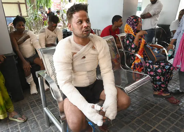 stock image NEW DELHI, INDIA JUNE 8 2024   Victims at Safdarjung hospital after a fire broke out in Dal factory early morning in Nerala industrial area H block , on June 8, 2024 in New Delhi, India. At least three workers were killed while six others critically 