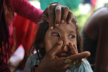 NEW DELHI INDIA JULY 24 2023 Flood affected people living in temporary tent sites are suffering with Eye Flu at Vikas Marg ITO on July 24 2023 in New Delhi India Photo by Salman Ali Hindustan Times clipart