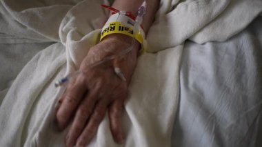 Hastane yatağında, serum damlası ve düşme riski olan bir bileziği olan hastaların yakın çekimleri. El beyaz çarşafların üzerinde dinleniyor ve odak noktası bilekte..