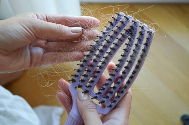 Düşmüş Saçlı Tarak: Kadın Kelliği