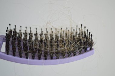 Düşmüş Saçlı Tarak: Kadın Kelliği