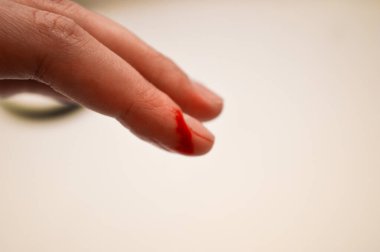Parmağında kanayan bir kesikle bir kadının yakın çekimi. Yara taze, görünür kan, acı, kazalar, ilk yardım ve yara bakımı konularını vurguluyor. Görüntü tıbbi, sağlık hizmetleri veya güvenlikle ilgili içerik için kullanılabilir, İllu.