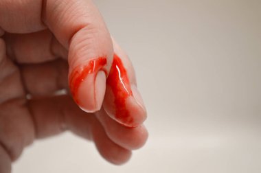 Parmağında kanayan bir kesikle bir kadının yakın çekimi. Yara taze, görünür kan, acı, kazalar, ilk yardım ve yara bakımı konularını vurguluyor. Görüntü tıbbi, sağlık hizmetleri veya güvenlikle ilgili içerik için kullanılabilir, İllu.