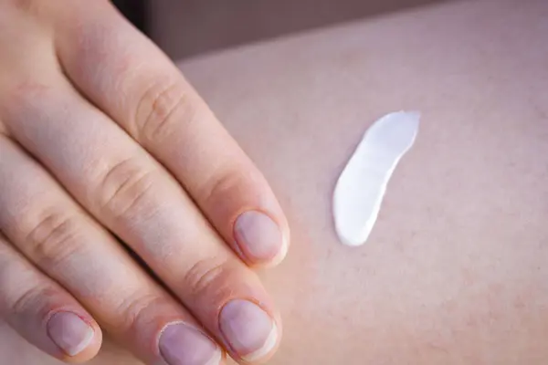 Bacağına krem süren bir kadın. SPF