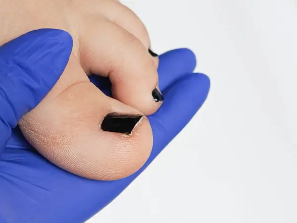 Bir romatolog ayak tabanını inceliyor. Ayakta romatizma eklem iltihabı. Eklem hastalıkları, bacak ağrıları.